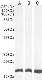 LGALS1 / Galectin 1 Antibody