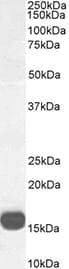 Polyclonal Rabbit anti-Human LGALS7 / Galectin 7 Antibody (IHC, WB)