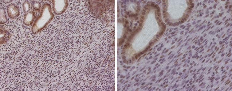 Polyclonal Rabbit anti-Mouse PR / Progesterone Receptor Antibody (IHC, WB)