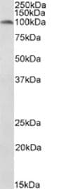 Polyclonal Rabbit anti-Mouse PR / Progesterone Receptor Antibody (IHC, WB)