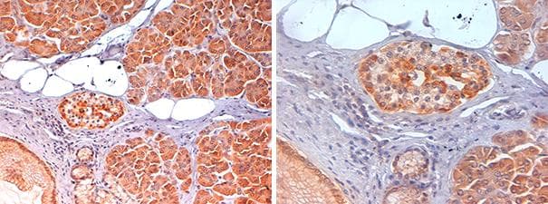 glk / Glucokinase Antibody
