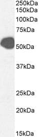 Polyclonal Rabbit anti-Human SLC2A2 / GLUT2 Antibody (IHC, WB)