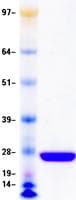 Human TK1 / TK / Thymidine Kinase Protein (Recombinant DDK,C-terminus)