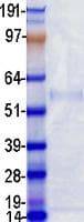 Human PCSK9 Protein (Recombinant DDK (Flag)-His, C-terminus)