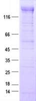 Human EGFR Protein (Recombinant Myc-DDK (Flag), C-terminus)