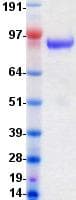 Human TEK / TIE2 Protein (Recombinant DDK (Flag)-His, C-terminus)