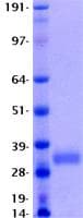 Human Adiponectin Protein (Recombinant His, N-Terminal)
