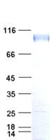 Human EGFR Protein (Recombinant His,C-terminus)