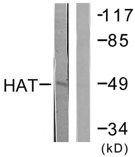 Polyclonal Rabbit anti-Human HAT1 Antibody (WB)