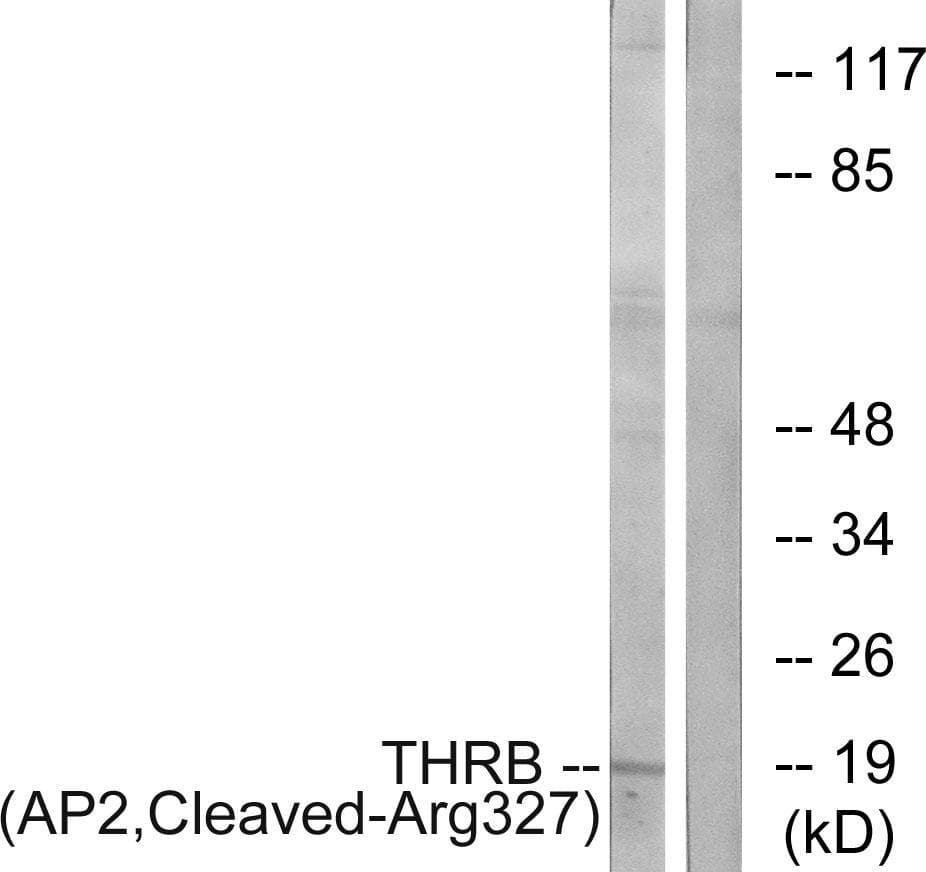 F2 / Prothrombin / Thrombin Antibody (AP2, Cleaved-Arg327)