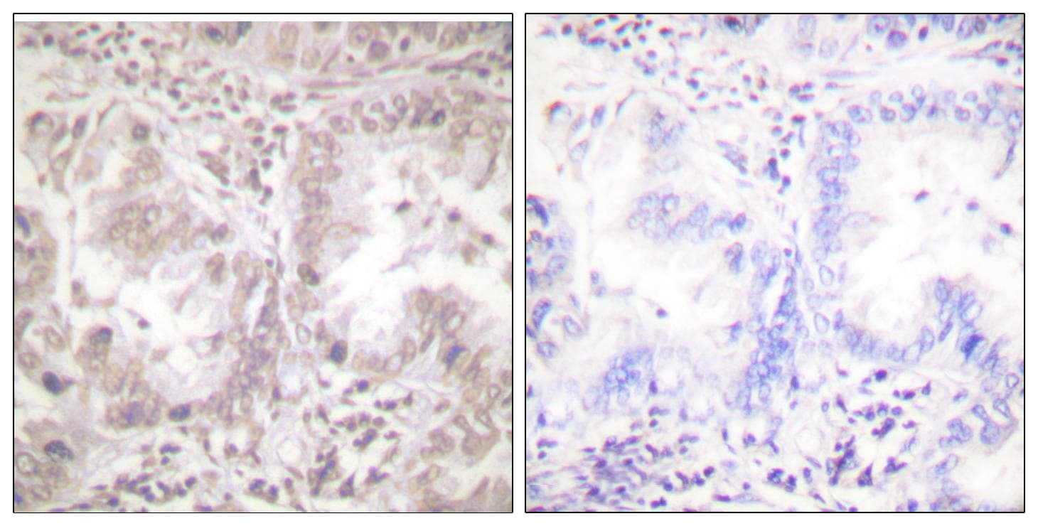 Polyclonal Rabbit anti-Human AKT1 Antibody (p450, IHC, WB)