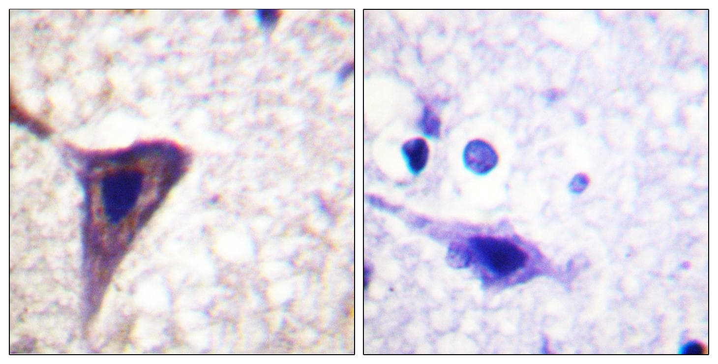 BID Antibody (phospho-Ser78)