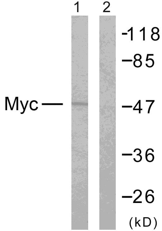 Polyclonal Rabbit anti-Human MYC / c-Myc Antibody (p358, IHC, WB)