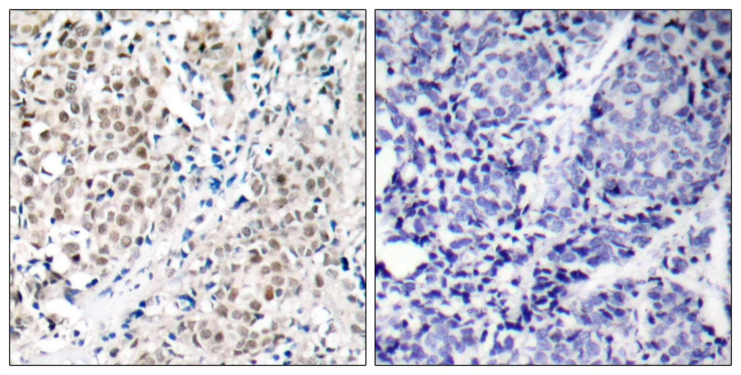 Polyclonal Rabbit anti-Human MYC / c-Myc Antibody (p358, IHC, WB)