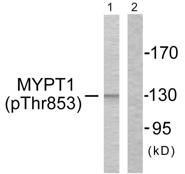 Polyclonal Rabbit anti-Human PPP1R12A / MYPT1 Antibody (phospho-Thr853, IHC, WB)
