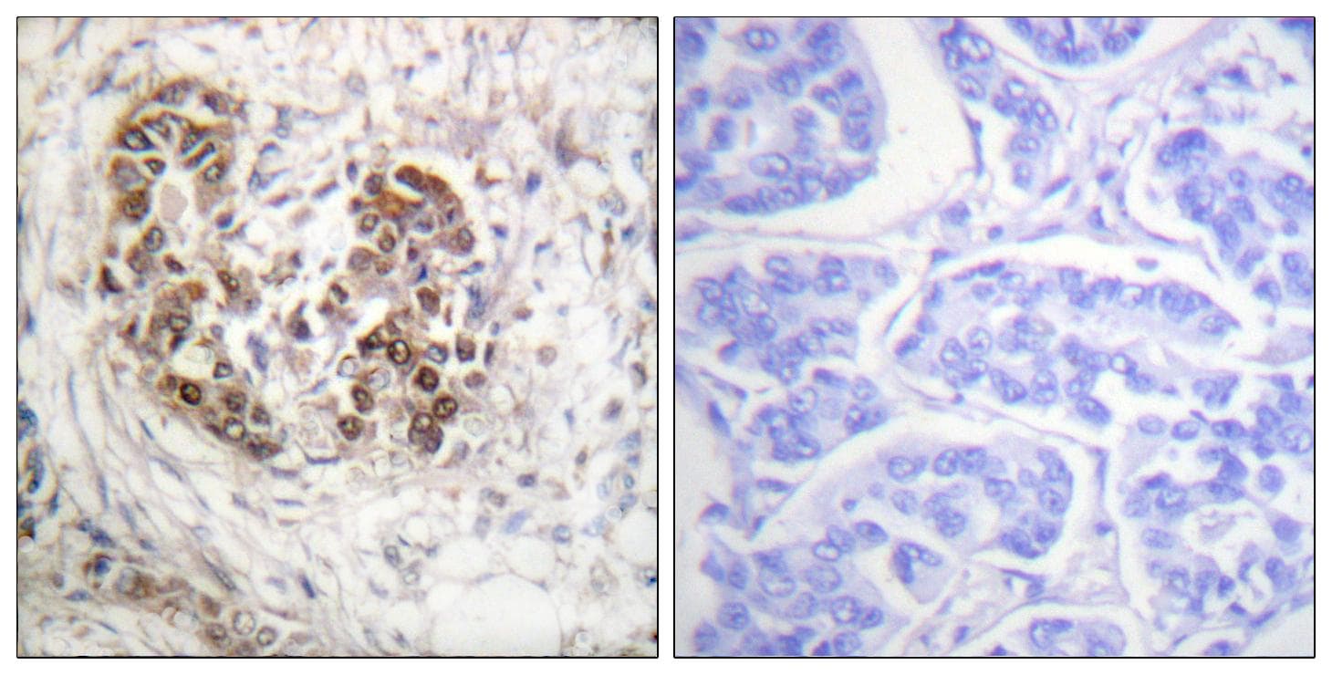 TP53 / p53 Antibody (p20)