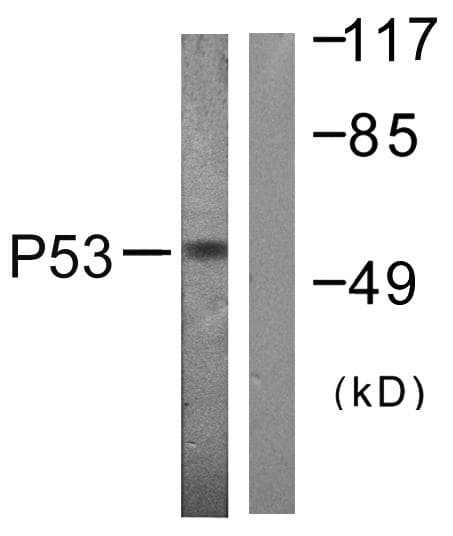 TP53 / p53 Antibody (p20)
