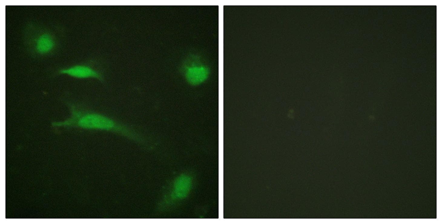 TP53 / p53 Antibody (p20)