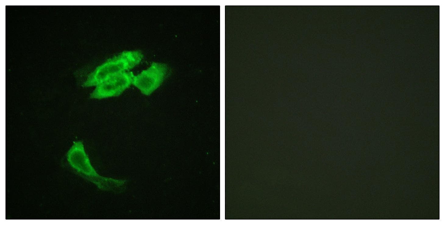 Polyclonal Rabbit anti-Human PEA15 / PEA-15 Antibody (p116, IHC, IF, WB)