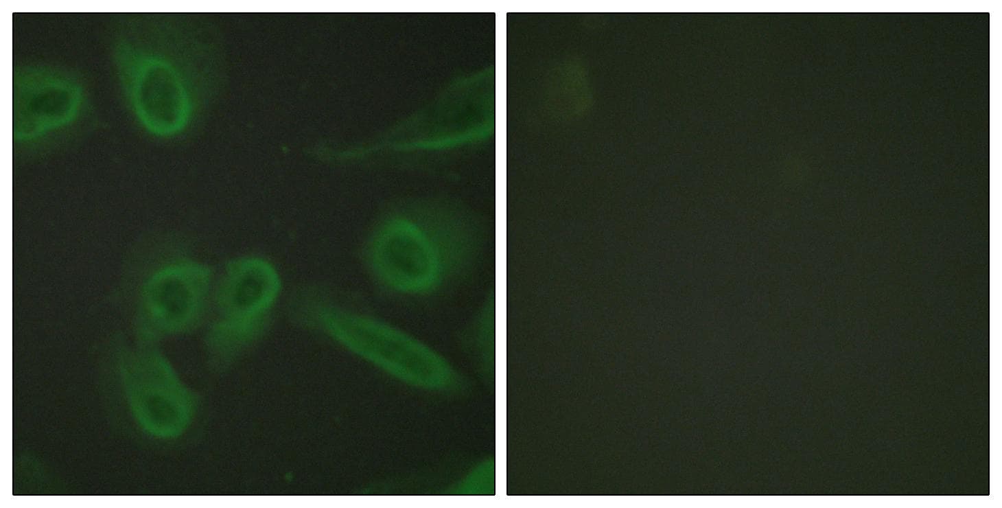 PECAM-1 / CD31 Antibody (p713)