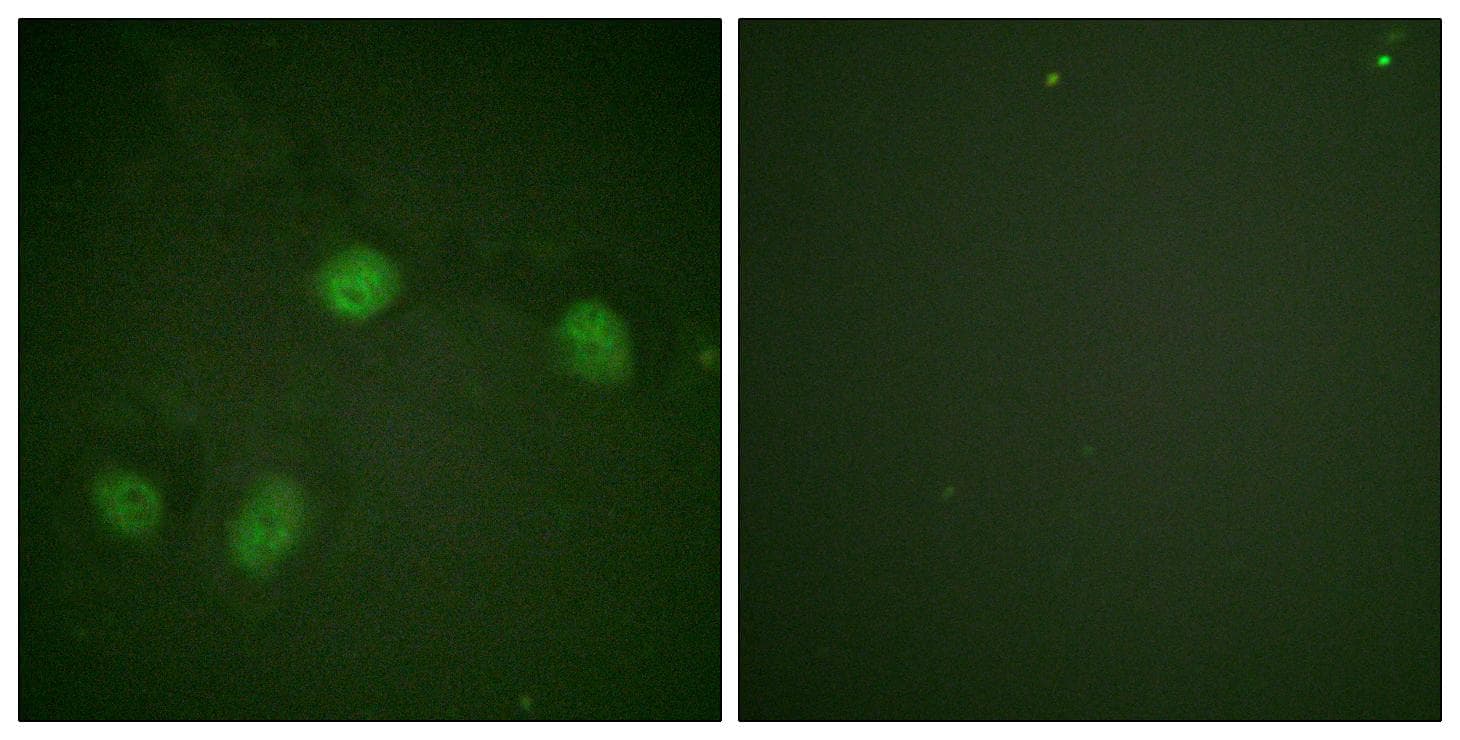 Polyclonal Rabbit anti-Human RAF1 / RAF Antibody (phospho-Ser621, IHC, IF, WB)