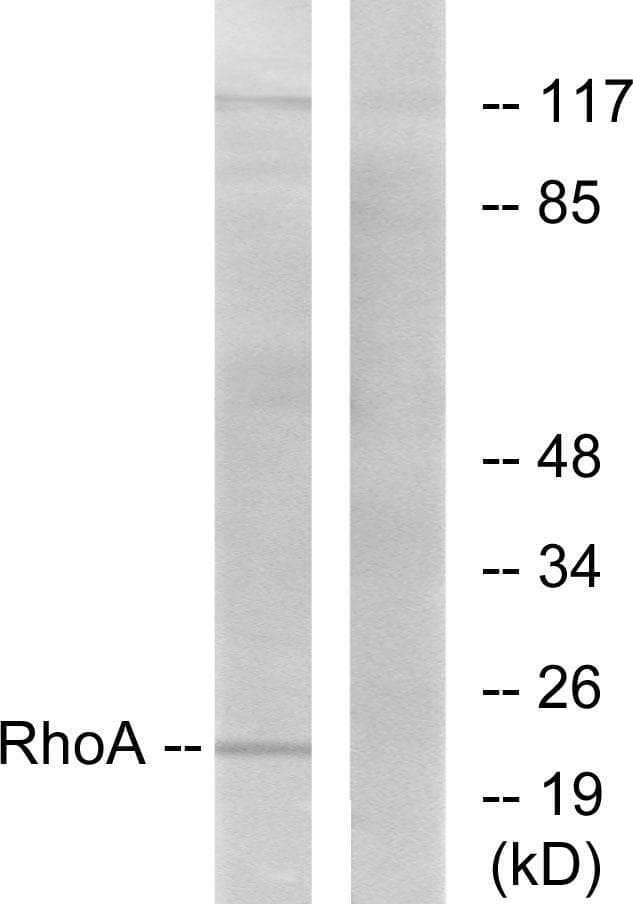 Polyclonal Rabbit anti-Human RHOA Antibody (p188, IHC, WB)