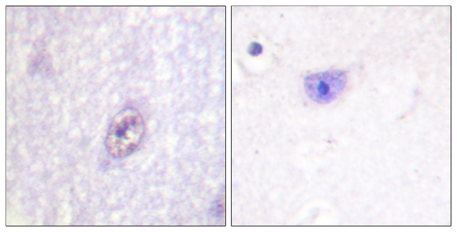 Polyclonal Rabbit anti-Human SP1 Antibody (p453, IHC, IF, WB)