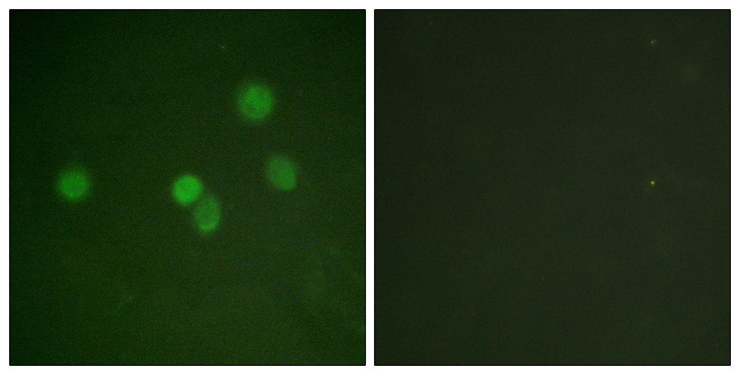 Polyclonal Rabbit anti-Human SP1 Antibody (p453, IHC, IF, WB)