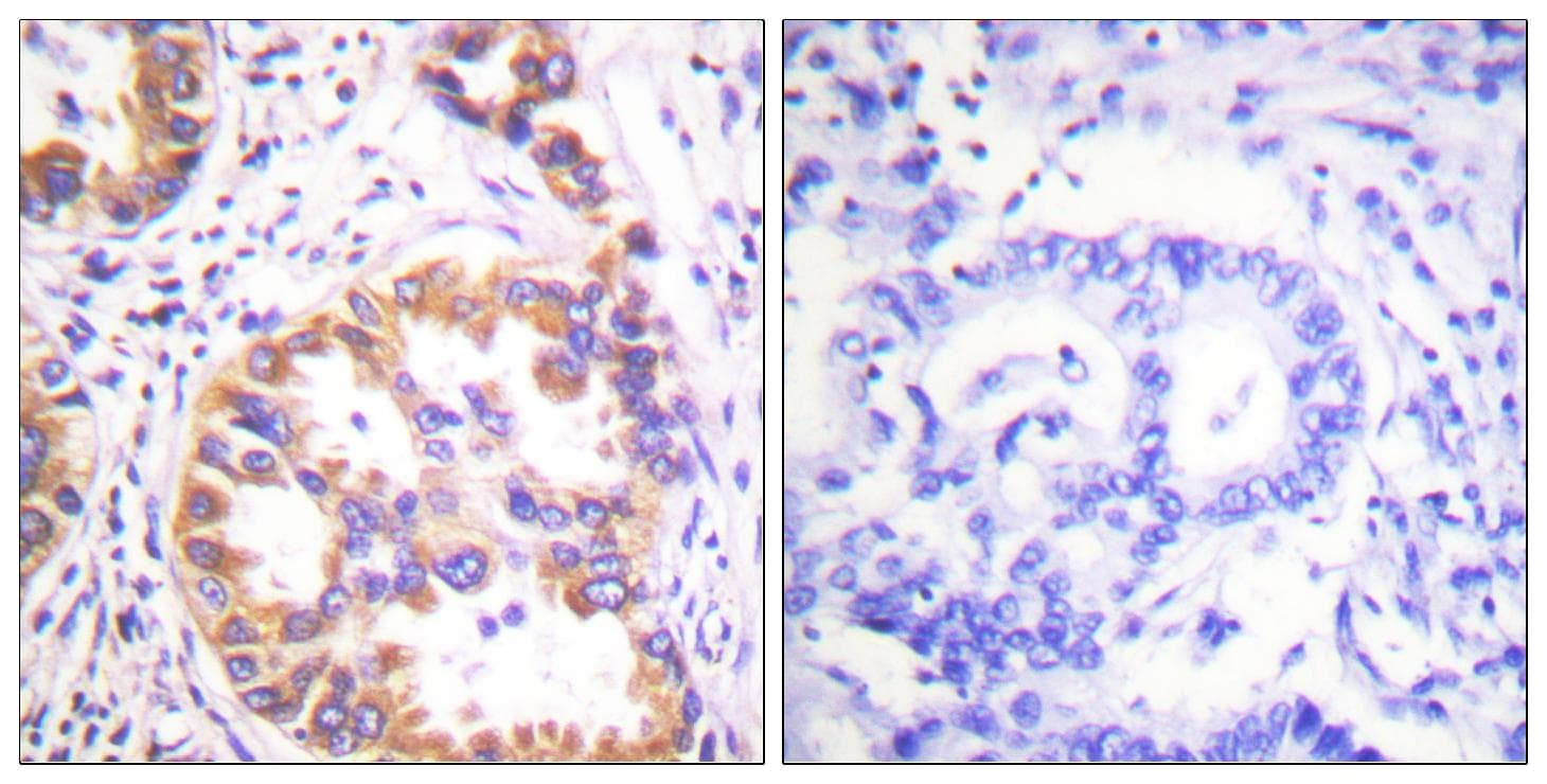 Tuberin / TSC2 Antibody (phospho-Ser939)