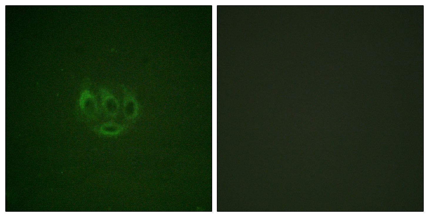 Polyclonal Rabbit anti-Human TNK2 / ACK1 Antibody (phospho-Tyr284, IHC, IF, WB)