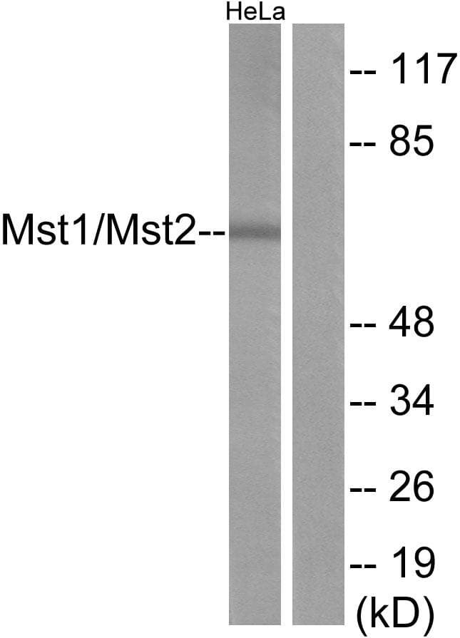Polyclonal Rabbit anti-Human STK4 Antibody (p183, IHC, WB)