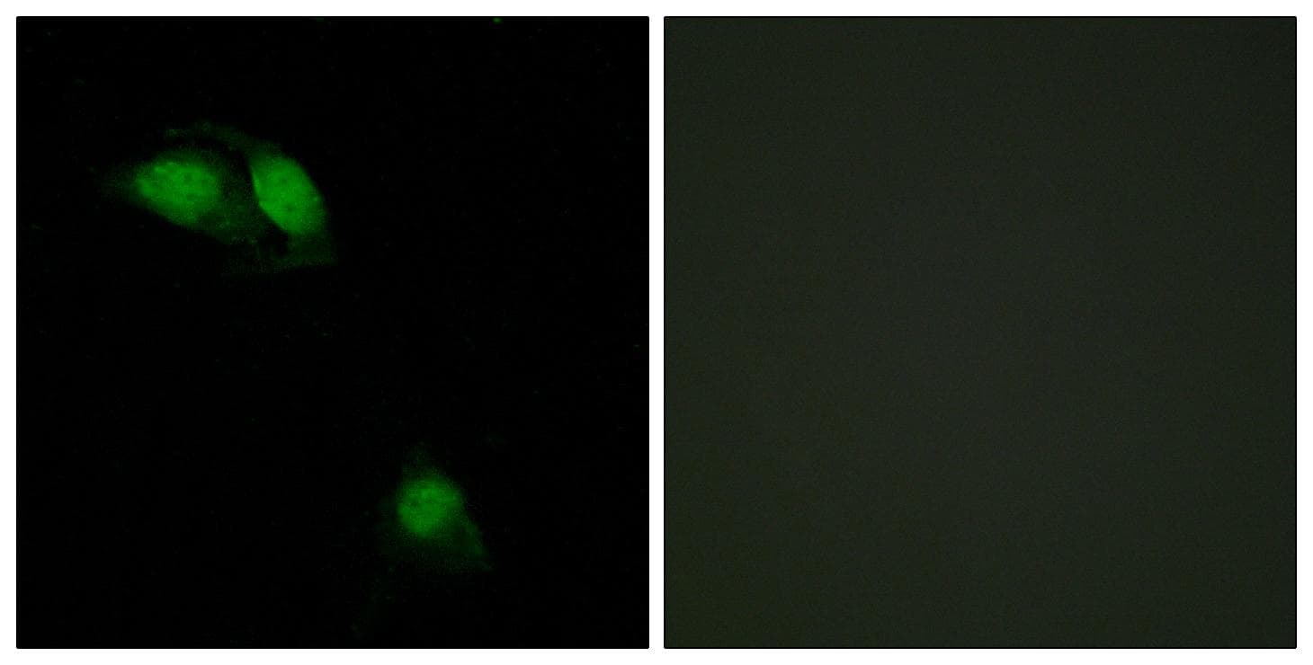 Polyclonal Rabbit anti-Human IRS1 Antibody (phospho-Ser312, IF, WB)