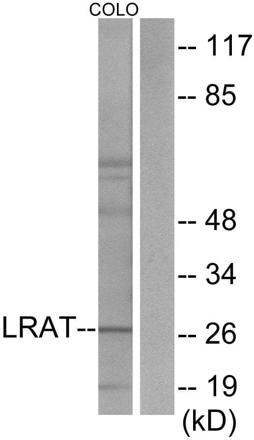 LRAT Antibody