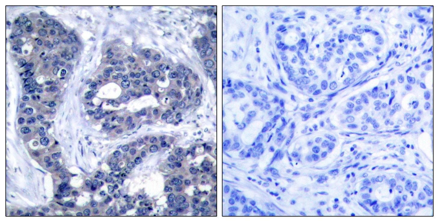 Polyclonal Rabbit anti-Human IRS1 Antibody (phospho-Ser639, IHC, WB)