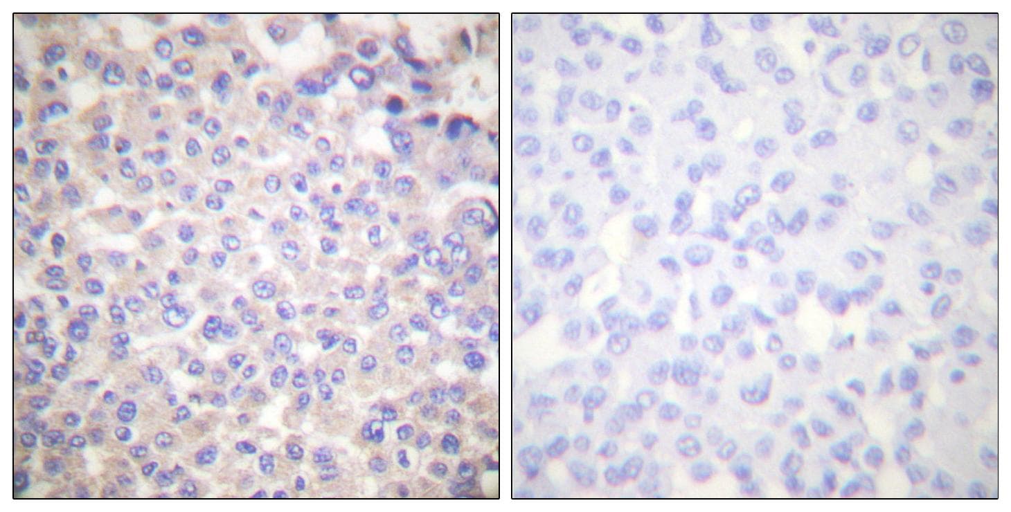 Polyclonal Rabbit anti-Human PLCG2 / PLC Gamma 2 Antibody (p753, IHC, WB)