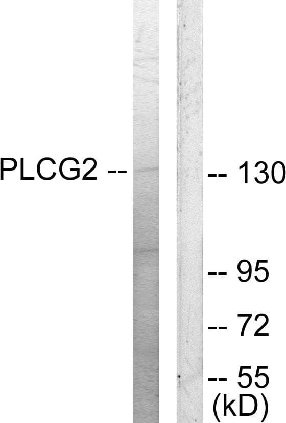 Polyclonal Rabbit anti-Human PLCG2 / PLC Gamma 2 Antibody (p753, IHC, WB)