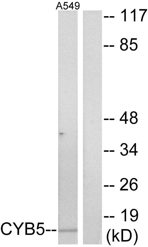 Polyclonal Rabbit anti-Human CYB5A / Cytochrome b5 Antibody (IF, WB)