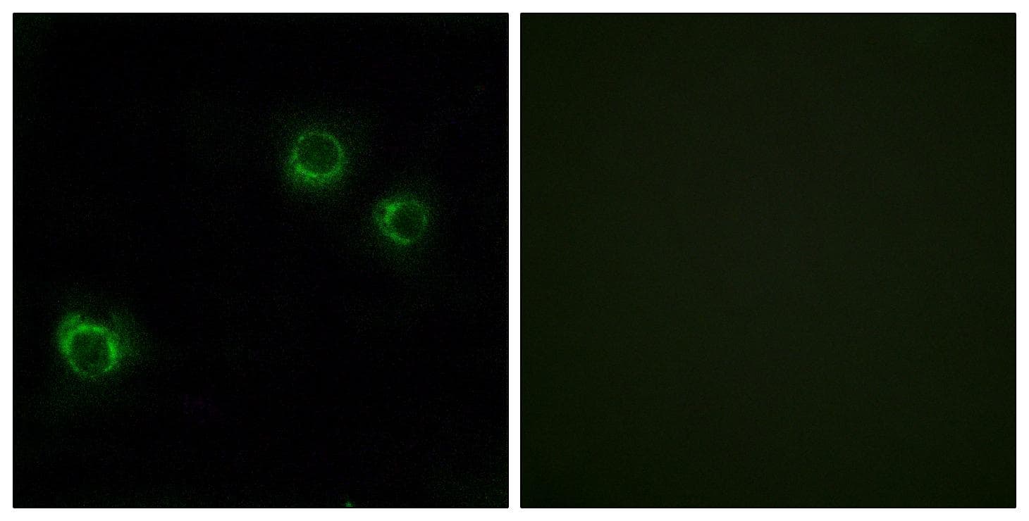 Polyclonal Rabbit anti-Human CLDN6 / Claudin 6 Antibody (IHC, IF, WB)