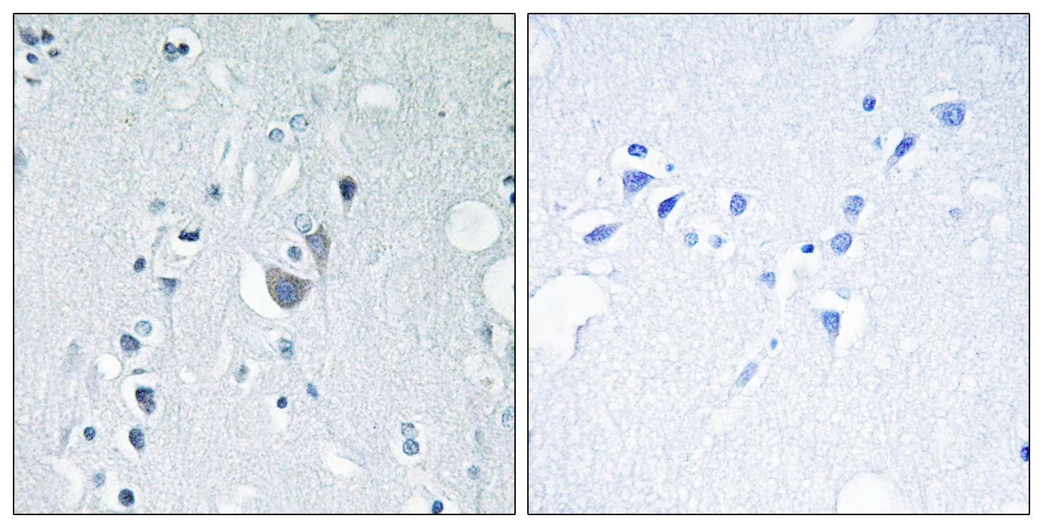 Polyclonal Rabbit anti-Human MAPK10 / JNK3 Antibody (phospho-Tyr185, IHC, WB)