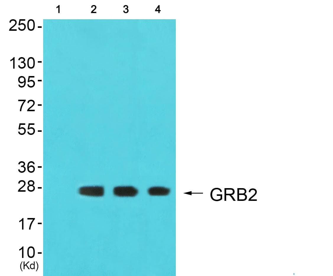 Polyclonal Rabbit anti-Human GRB2 Antibody (WB)