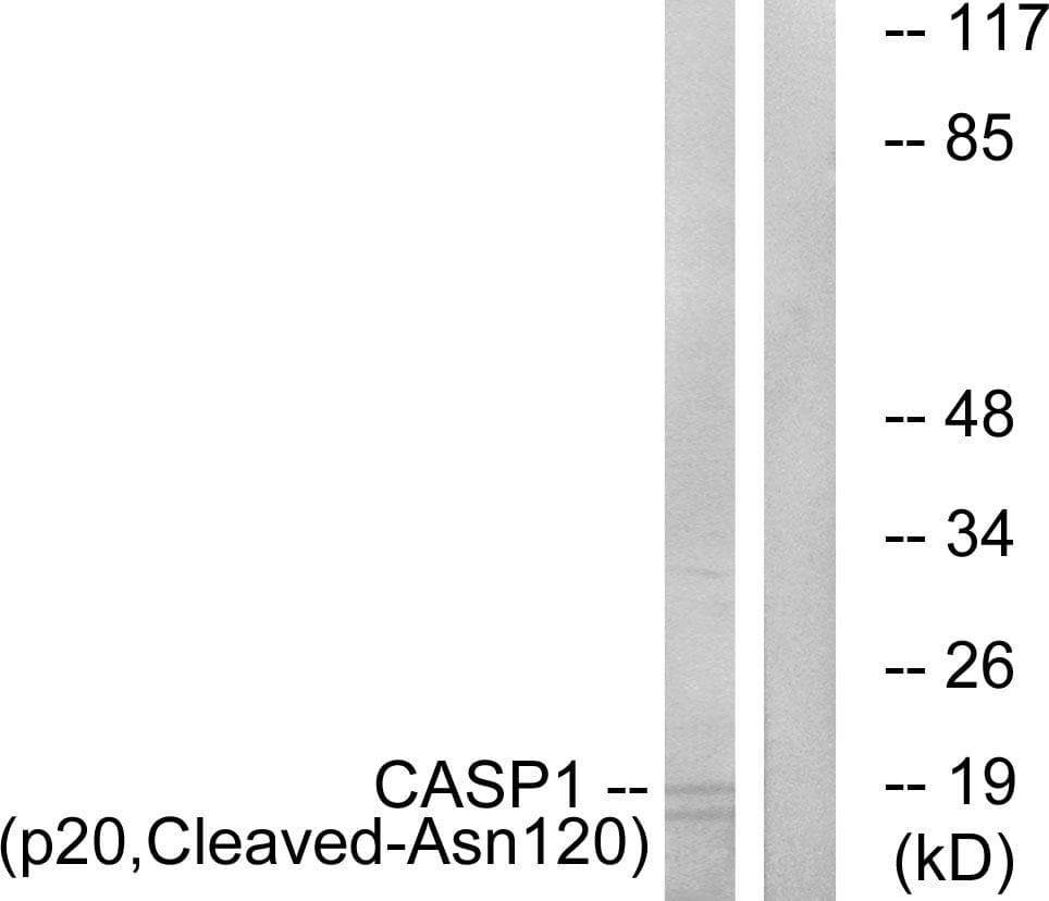 CASP1 / Caspase 1 Antibody (p20, Cleaved-Asn120)