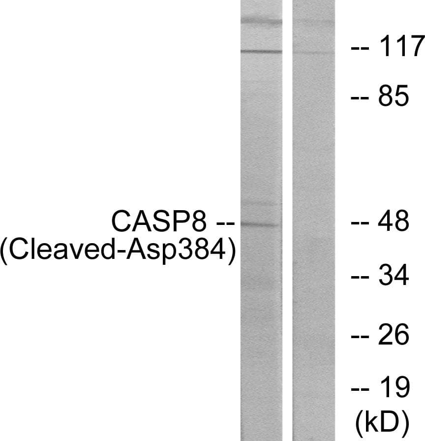 CASP8 / Caspase 8 Antibody (Cleaved-Asp384)