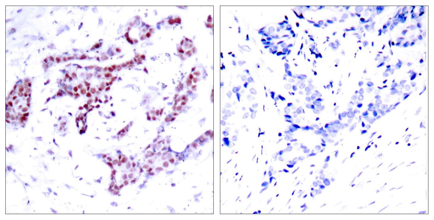 Polyclonal Rabbit anti-Human STAT1 Antibody (phospho-Tyr701, IHC, WB)