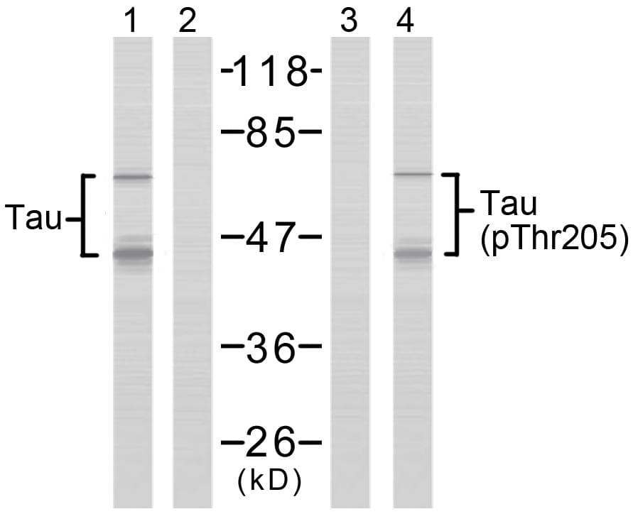 MAPT / Tau Antibody (phospho-Thr205)