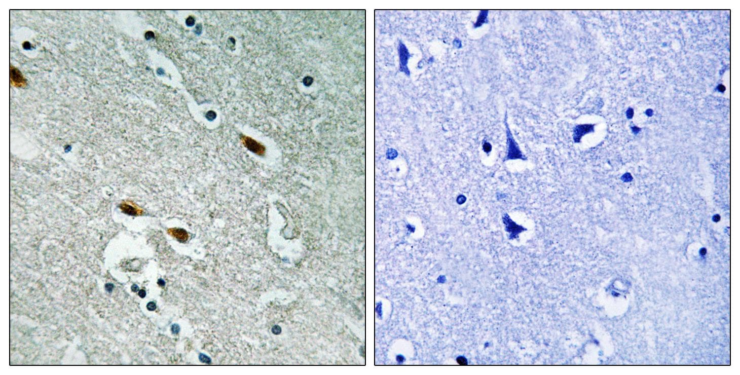 TP53BP1 / 53BP1 Antibody (Ab-1778)