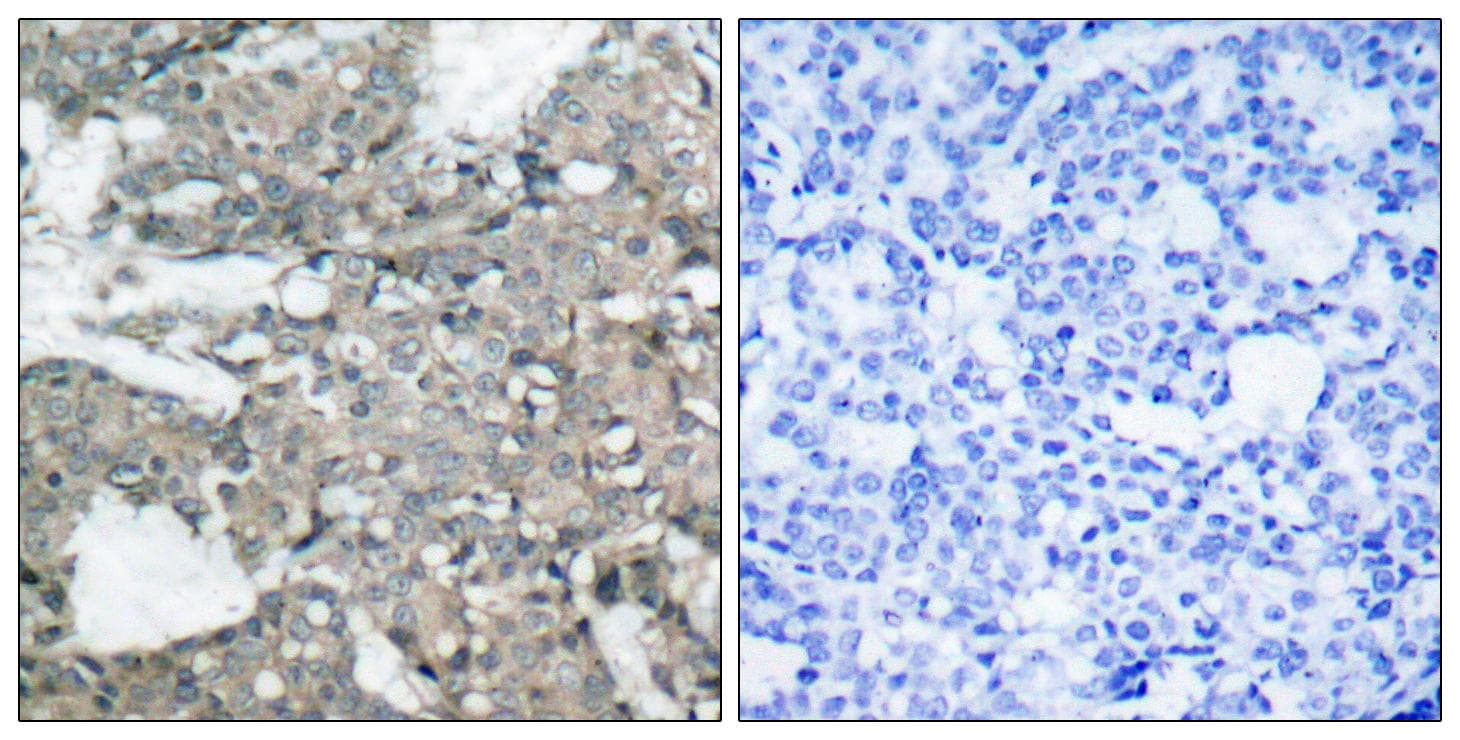 Polyclonal Rabbit anti-Human MEK1 + MEK2 Antibody (p221, IHC, WB)