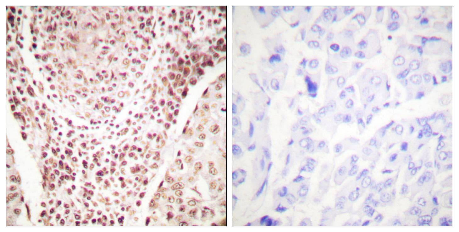CHEK2 / CHK2 Antibody (phospho-Thr387)