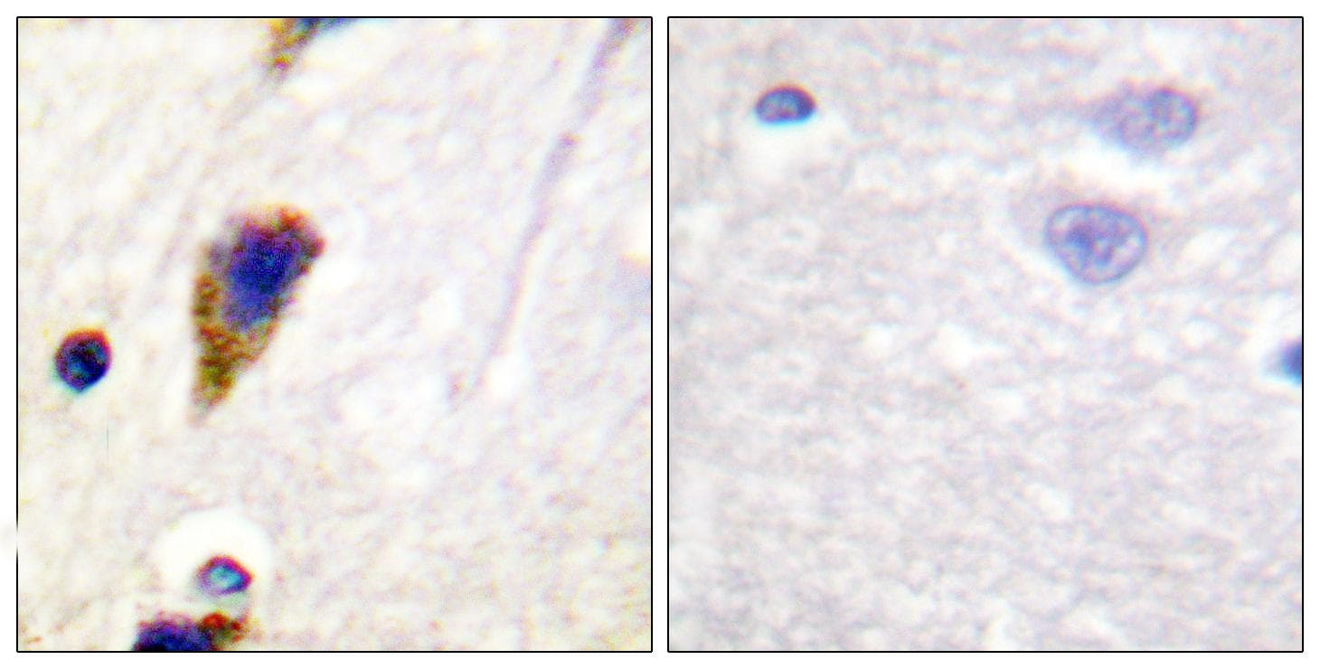 Polyclonal Rabbit anti-Human DNM1 / Dynamin Antibody (p774, IHC, WB)
