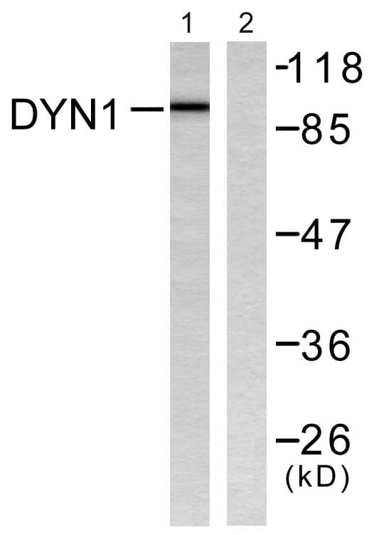 Polyclonal Rabbit anti-Human DNM1 / Dynamin Antibody (p774, IHC, WB)