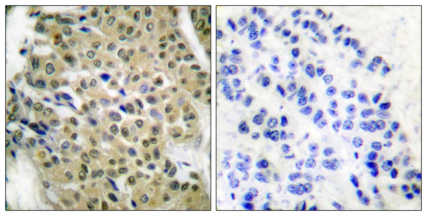 Polyclonal Rabbit anti-Human HDAC5 Antibody (p259, IHC, WB)